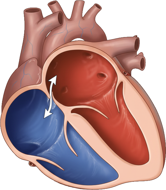 Offenes Formalen ovale (Schema)